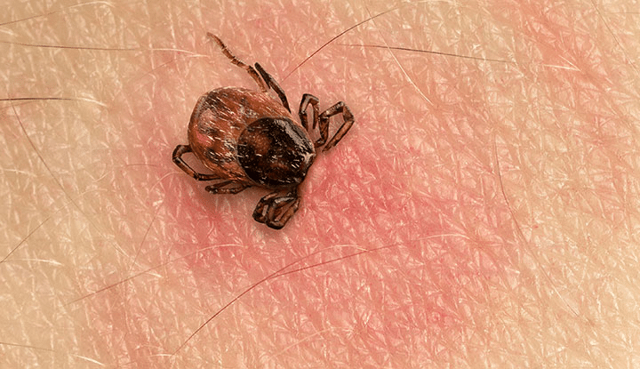 Effective Home Remedies for Tick Removal